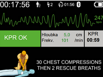 DefiSign Pocket Plus EKG-skjerm   - 11527